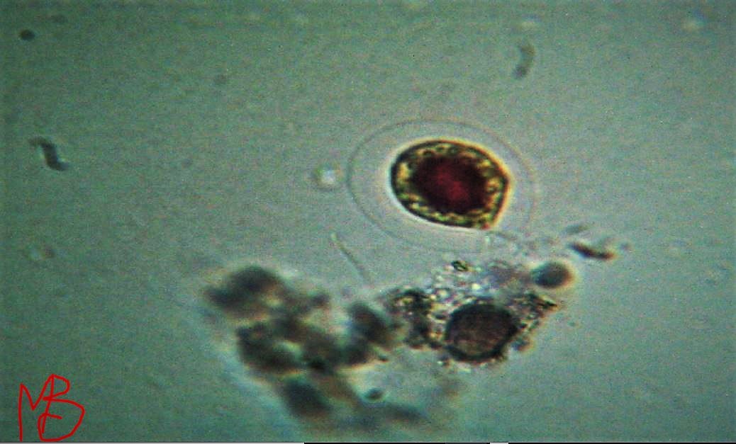 Haematococcus pluvialis